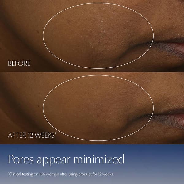 Estee Lauder&#8482; Advanced Night Repair Serum w/ Hyaluronic Acid