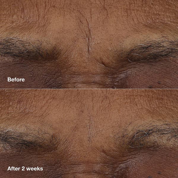 Clinique Smart Clinical Balm