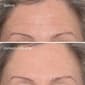 Murad Targeted Wrinkle Corrector - image 3