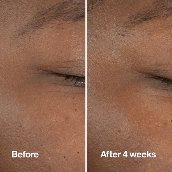 Clinique Clarifying Do-Over Peel