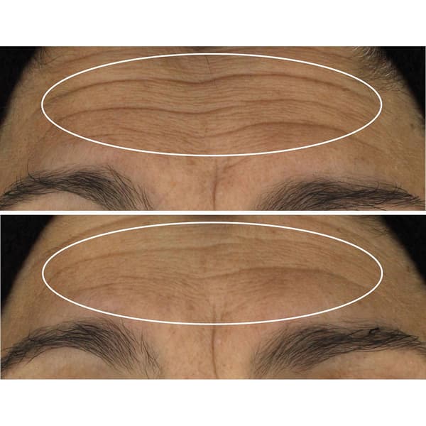 StriVectin Wrinkle Recode Line Transforming Melting Serum