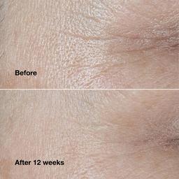Clinique Smart Clinical Repair™ Wrinkle Correcting Face Cream