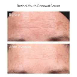 Murad Retinol Youth Renewal Serum
