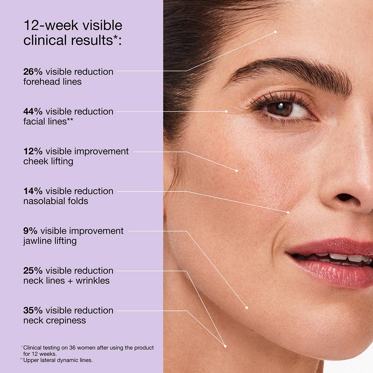 Clinique Smart Clinical Repair™ Lifting Face + Neck Cream