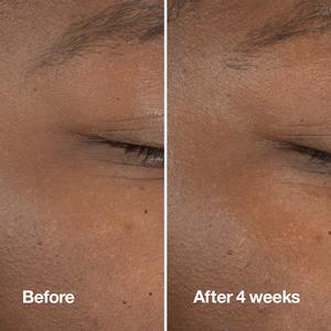 Clinique Clarifying Do-Over Peel alternate view