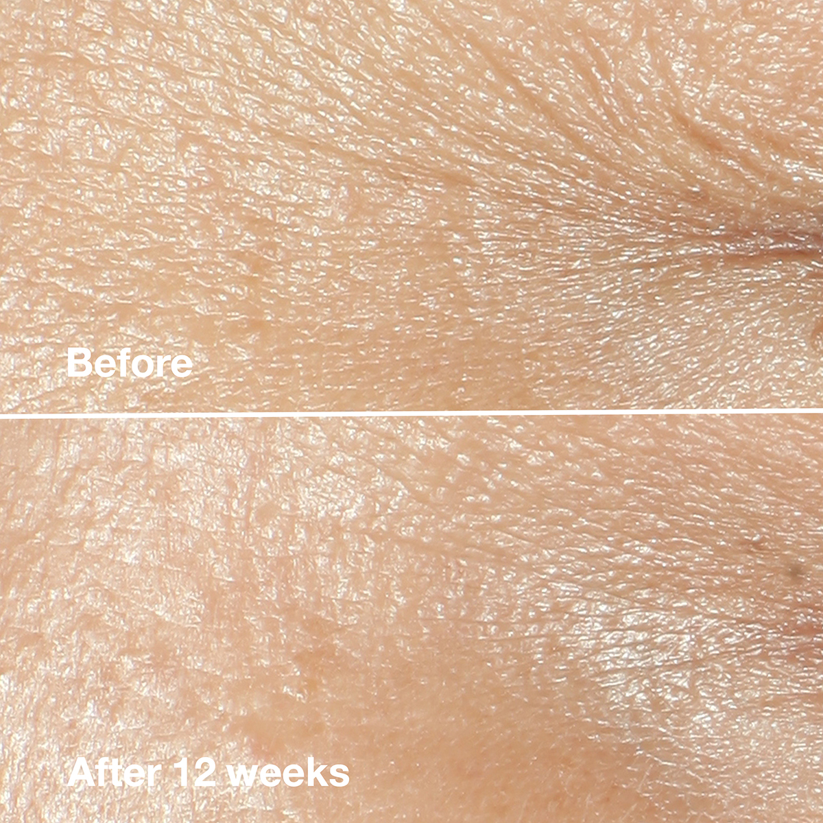 Clinique Smart Clinical Repair(tm) Wrinkle Correcting Face Cream