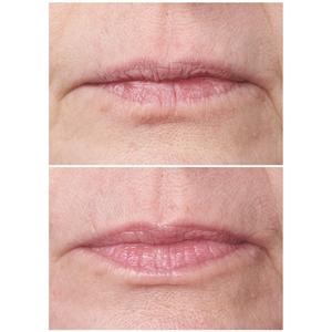 StriVectin(R) Double Fix Lip Plumping & Vertical Line Treatment alternate view