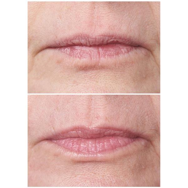 StriVectin(R) Double Fix Lip Plumping & Vertical Line Treatment alternate view