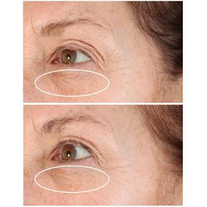 StriVectin(R) Discovery Series: Tighten & Lift Trio Kit alternate view