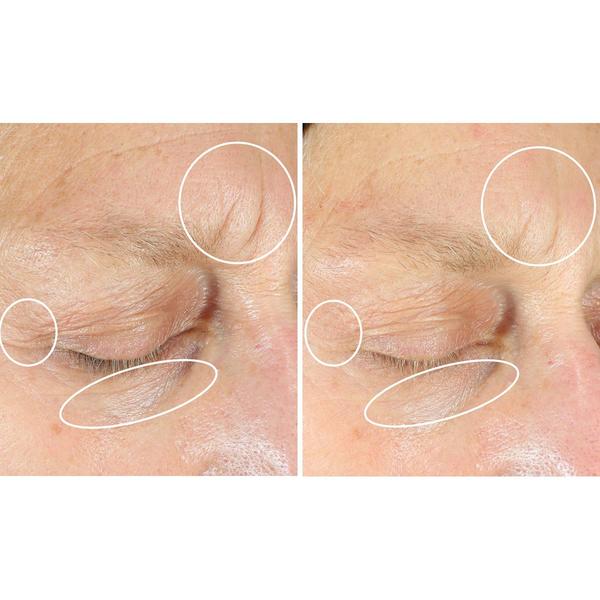 StriVectin(R) Intensive Eye Concentrate for Wrinkles Plus alternate view