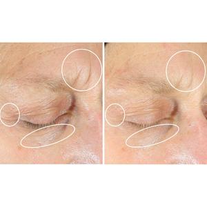 StriVectin(R) Intensive Eye Concentrate for Wrinkles Plus alternate view