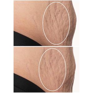 StriVectin(R) SD Advanced(tm) PLUS Intensive Moisturizing Concentrate alternate view