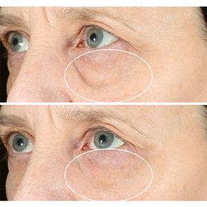 StriVectin(R) Hyperlift Eye(tm) Instant Eye Fix alternate view