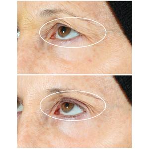 StriVectin(R) Peptight(tm) 360 Tightening Eye Serum alternate view