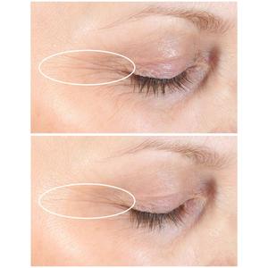 StriVectin(R) Discovery Series Anti-Wrinkle Travel Trio alternate view