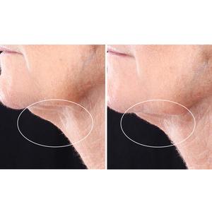 StriVectin(R) Peptight(tm) Neck Serum Roller alternate view