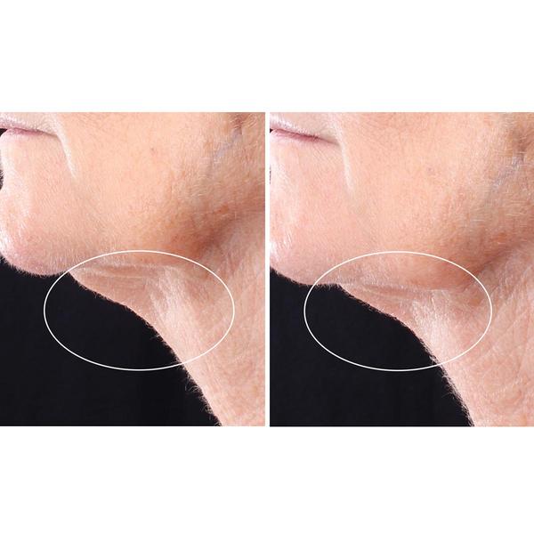 StriVectin(R) Peptight(tm) Neck Serum Roller alternate view
